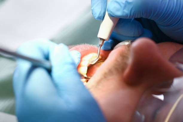 Best Emergency Dental Care for Sports Injuries in Grove City, PA