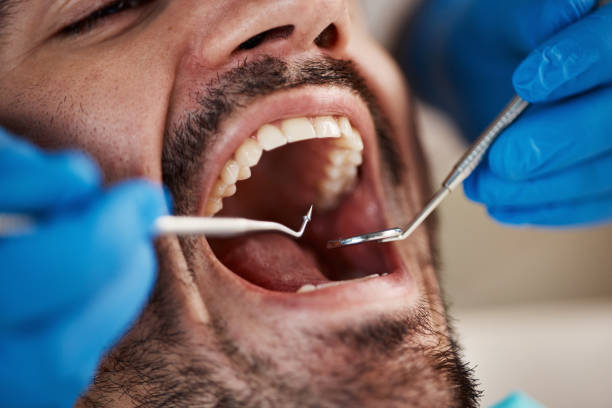 Best Emergency Denture Repair in Grove City, PA